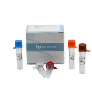 Kit de PCR em Tempo Real para o Vírus da Influenza Aviária (H5/H7/H9)